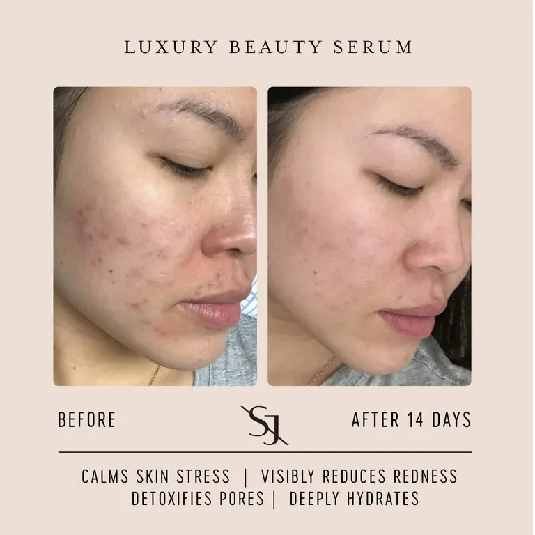Luxury Face Serum