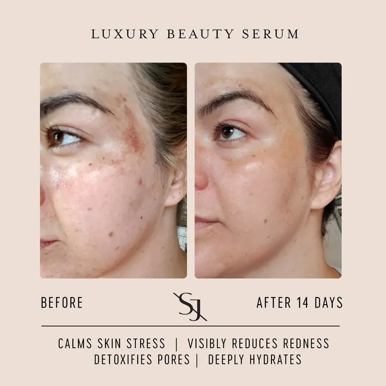 Luxury Face Serum